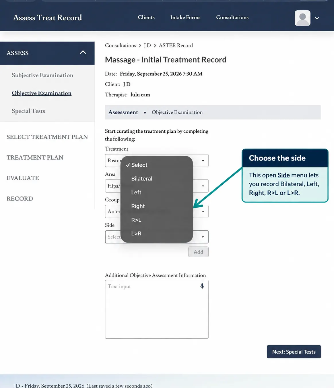 Screenshot showing the Side dropdown open